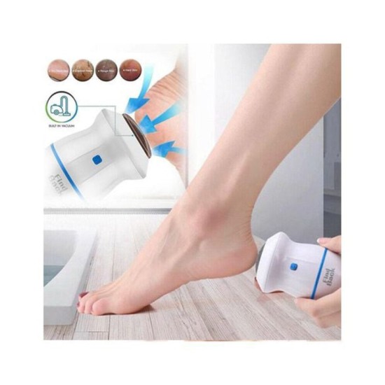 FIND BACK CALLUS REMOVER FIND BACK CALLUS REMOVER